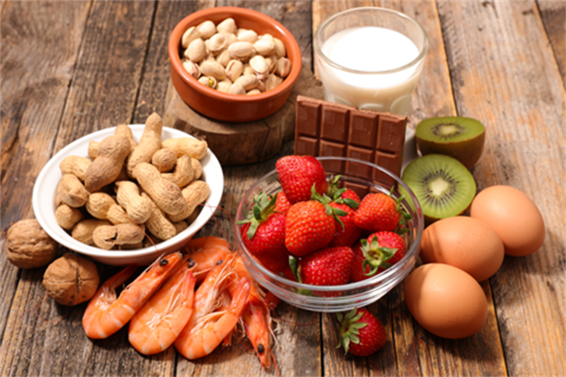 Common food allergens, peanuts, eggs, seafood, milk, strawberries, kiwi
